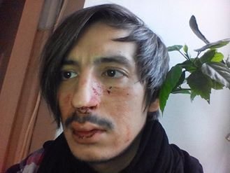 В Одессе на почве ненависти к геям избили двух мужчин 