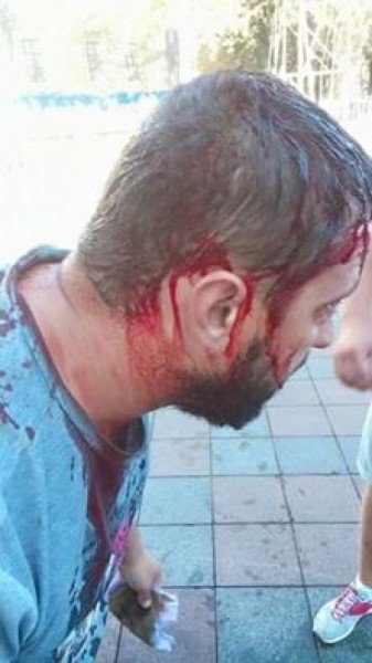 Известный одесский общественник пострадал во время разгона антитрухановского майдана