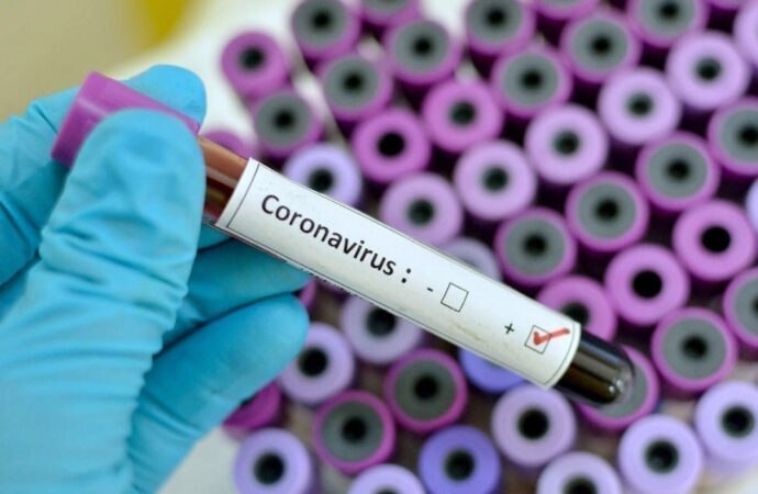 В Україні зареєстровано 41 випадок захворювання на коронавірусну інфекцію COVID-19