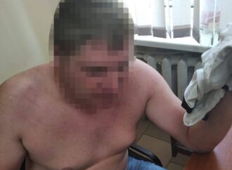 Покусав та бив в обличчя: на Одещині чоловіку напідпитку оголосили підозру в насильстві