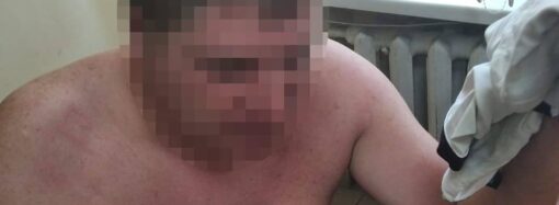 Покусав та бив в обличчя: на Одещині чоловіку напідпитку оголосили підозру в насильстві