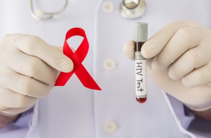Где в Одессе можно бесплатно пройти тест на  ВИЧ?