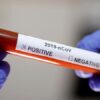 Обнаружен новый штамм коронавируса – гибрид «Дельты» и «Омикрона»