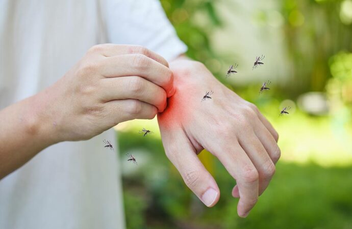 Как различить укусы насекомых, чем они опасны, как помочь пострадавшему?