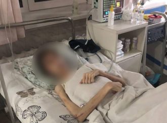 Лечили «духовно»: в Одессе родители морили голодом 16-летнего сына