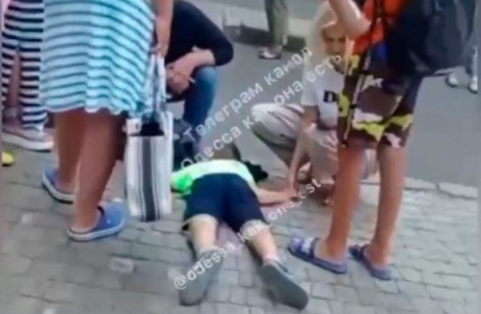 В центре Одессы серьезно травмировался подросток – упал с самоката