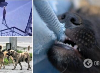 На поселке Котовского бездомные собаки напали на ребенка