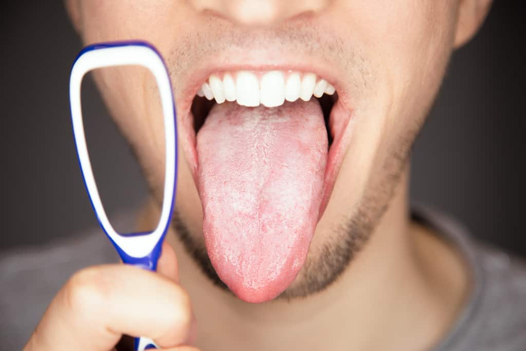 воспаление языка глосит глоссит запалення 1