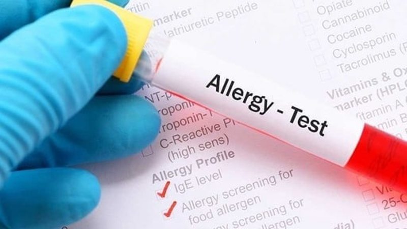 Аналіз на алергію