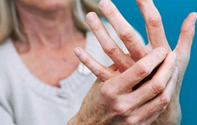 Спросите у доктора: чем опасен артрит пальцев