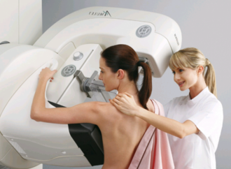 Як зробити мамографію безкоштовно?