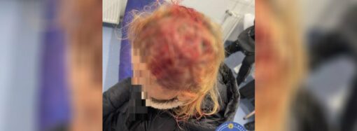 На Водопроводной часть фасада упала женщине на голову