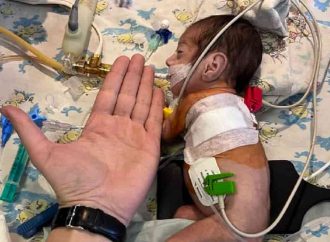 Одеські медики вдало прооперували двох малюків із пороком серця