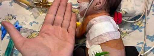 Одесские медики удачно прооперировали двух малышей с пороком сердца