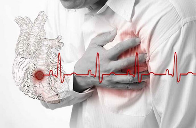 Ишемическая болезнь сердца: как вовремя распознать проблемы
