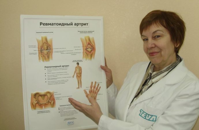 лікар-ревматолог Наталія Герасименко