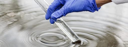 Воду в Одесі та області перевірили на холеру: результати аналізів (ОНОВЛЕНО)