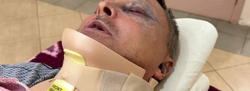 Під Одесою жорстоко побили військового – у нього зламана шия (відео)