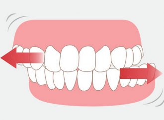 Бруксизм или скрежет зубами: что это за болезнь и как с ней бороться