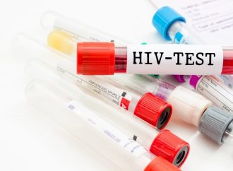 Где в Одессе и области можно сделать тест на ВИЧ