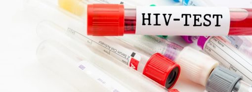 Де в Одесі та області можна зробити тест на ВІЛ