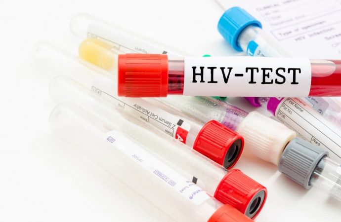 Где в Одессе и области можно сделать тест на ВИЧ