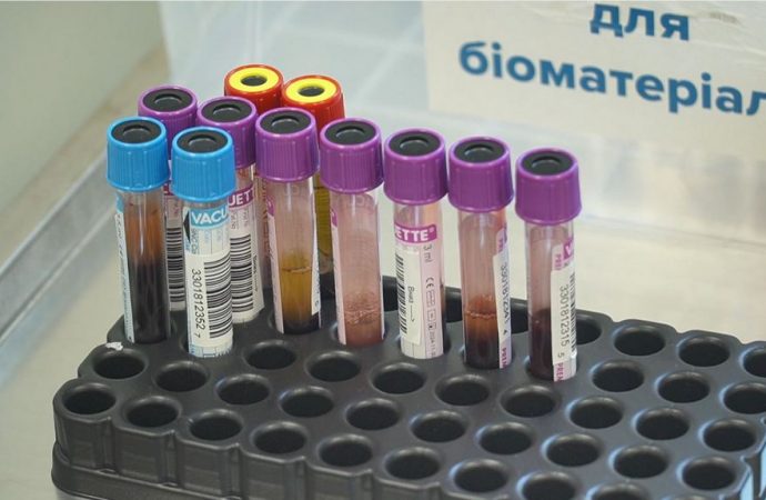 Здача аналізів крові в Одесі