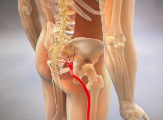 «Мурашки» в ногах і параліч: як розпізнати і що робити з невралгією сідничного нерва