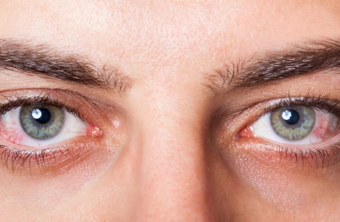 Сухость и песок в глазах: что такое синдром сухого глаза?