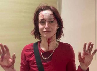 Человек в форме избил девушку костылями: одесситка обвиняет ТЦК