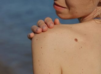 Рак шкіри: види, ознаки та фактори ризику