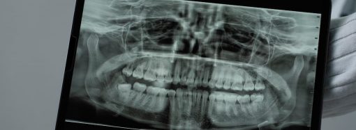 3D-снимок зубов