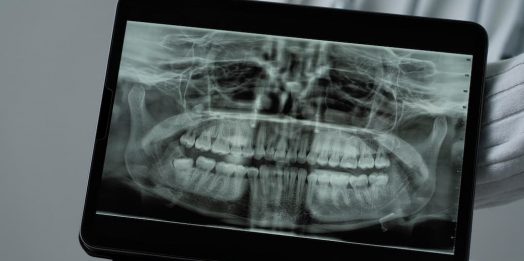 3D-снимок зубов