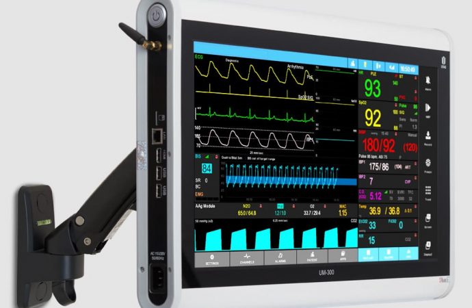 Монітори пацієнта та їх особливості