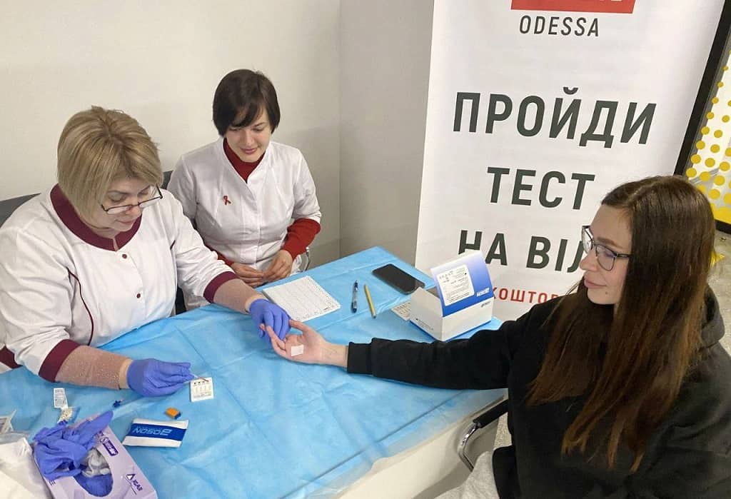 Тест на ВИЧ