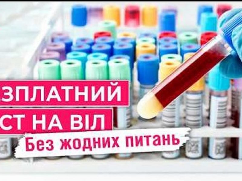 Тест на ВИЧ в Одессе