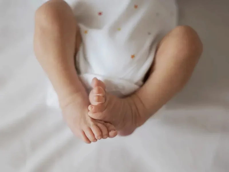 Дисплазія кульшового суглоба