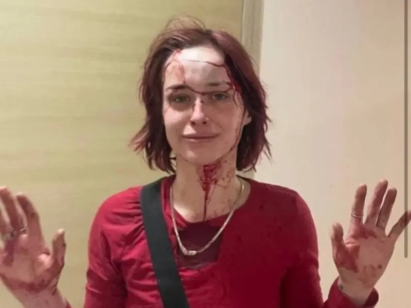 В Одессе сотрудник ТЦК избил девушку костылем