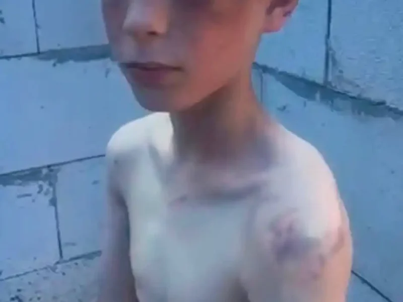 прийомна мати побила дитину